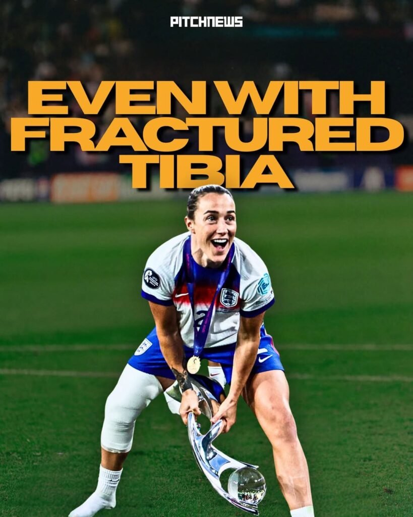 Lucy Bronze Played Euro 2025 with Fractured Tibia Bronze